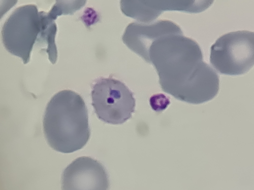 funed-reforca-combate-a-malaria-com-diagnostico-agil-e-capacitacao-de-profissionais 