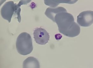 funed-reforca-combate-a-malaria-com-diagnostico-agil-e-capacitacao-de-profissionais 